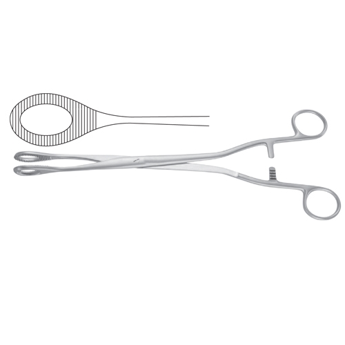 Noto Uterine Polypus 